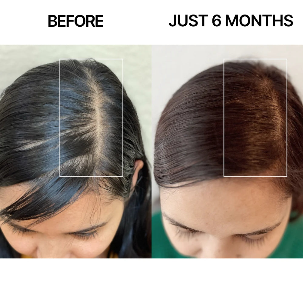 Before and after comparison of hair growth on a person's head.